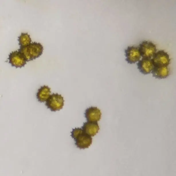 Pollens of Chrysanthemum – Foto: edurafi2 (CC BY-SA 4.0)